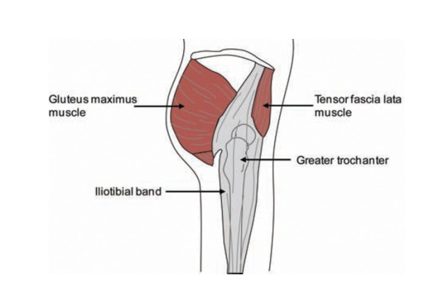 External snapping hip occurs lateral to the hip joint and is attributed to the abrupt movement of th